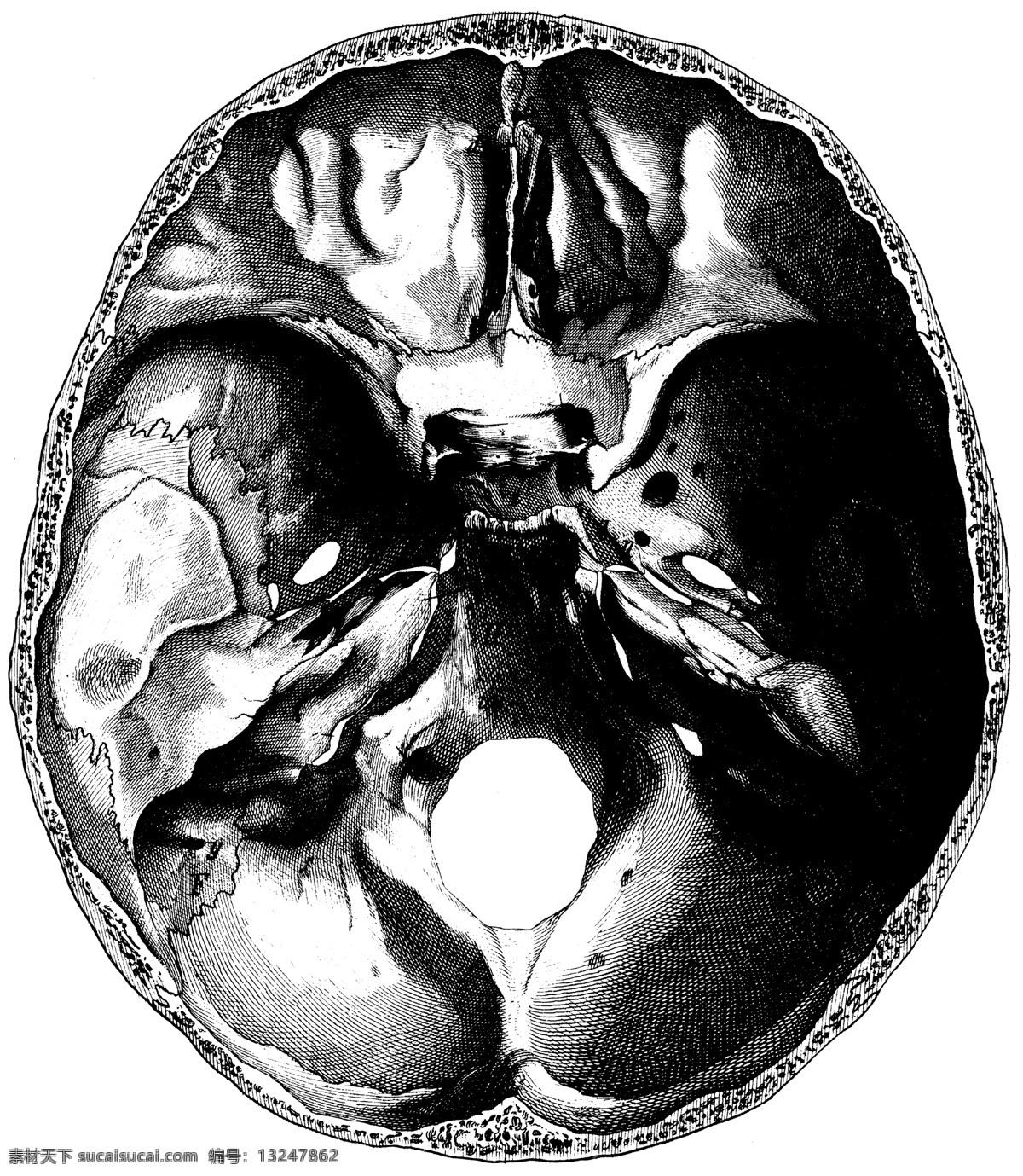 人体 头盖骨 切片 内部 ct 侧面 头骨 医学 解剖 法医 骷髅 核磁共振 人体解剖 医疗护理 现代科技