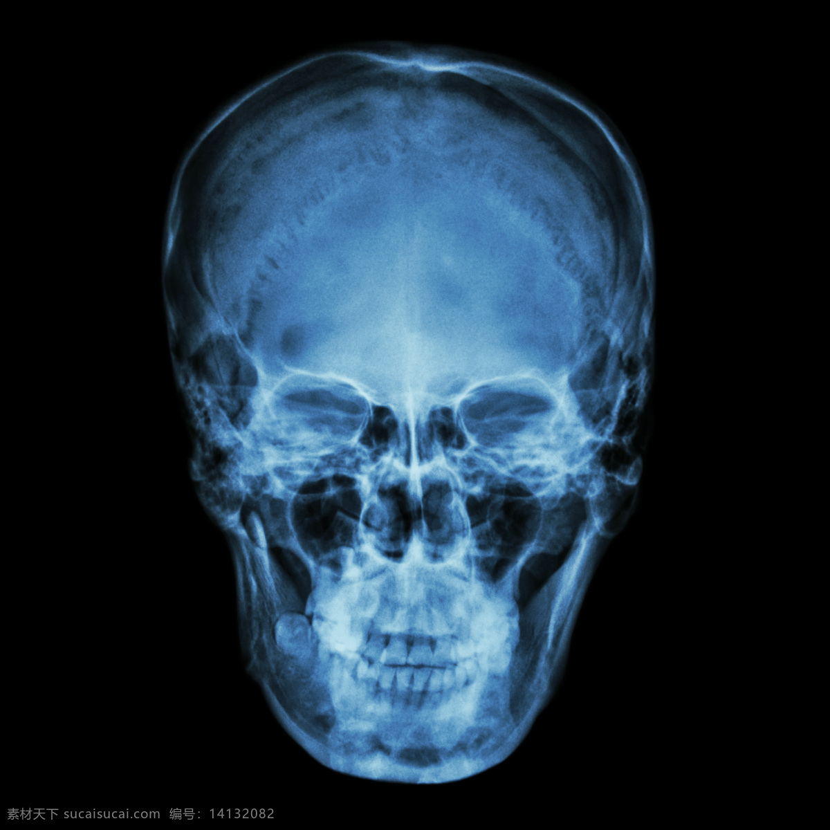 人 脸部 x 光 片 医疗护理 医学研究 x光片 x光片图片 医疗 拍片 医学研究素材 护理 图片库 现代科技