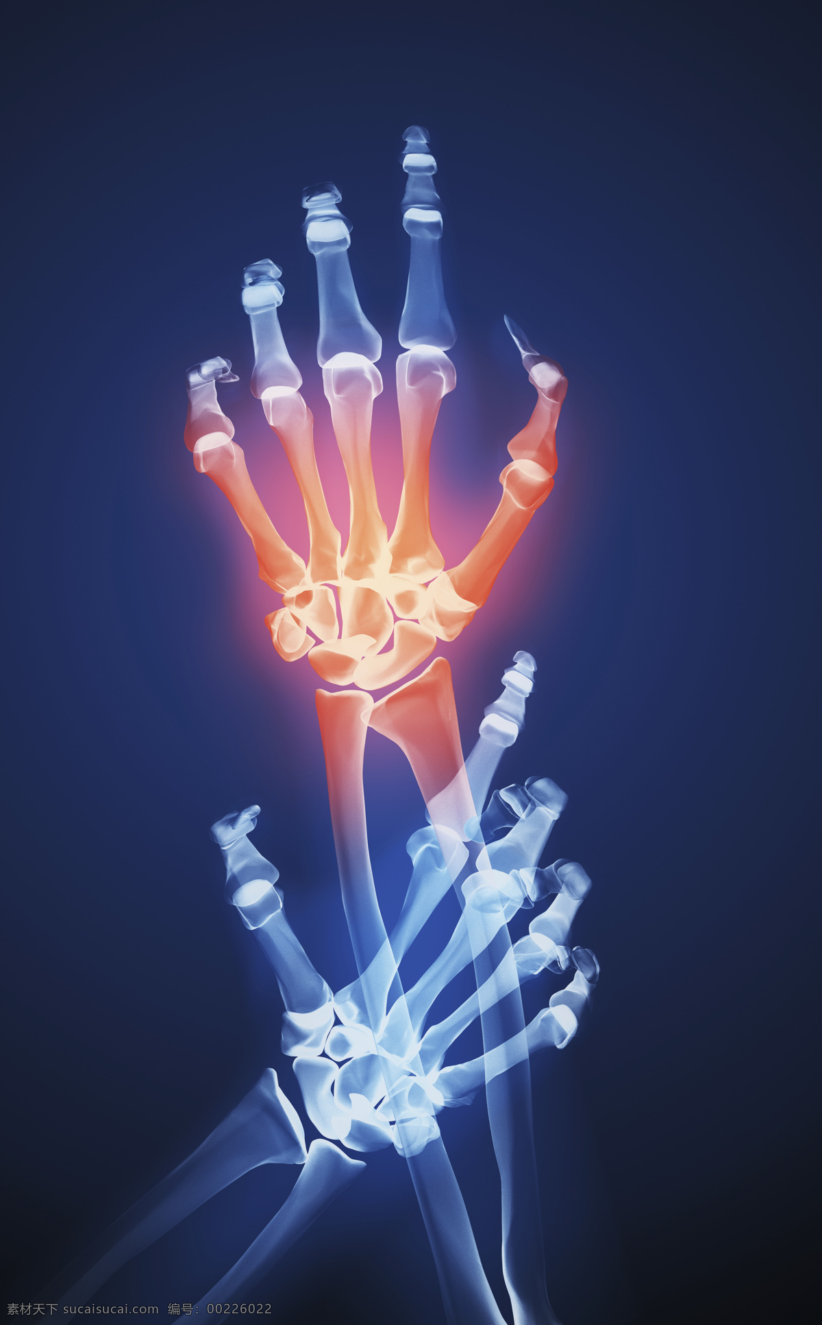 人体 手腕 x 光 透视图 医疗主题 x光 图像 医疗护理 现代科技