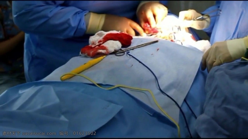 人物 手术 视频 人物视频素材 手术视频 医生 医院视频 手术室 实拍视频 视频素材 中