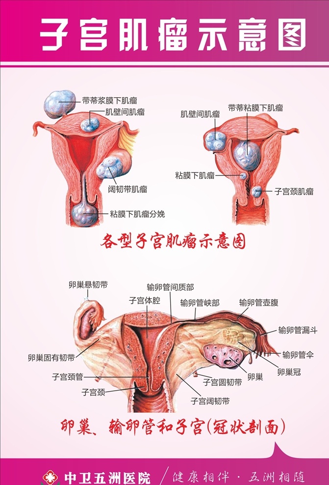 子宫肌瘤 医院 院内 文化 企业 企划 宣传 子宫 肌瘤 妇科 专科 卵巢 卵巢囊肿 阴道 女人 美丽 综合 医疗 美容 整形 医美 唯美 解剖 妇女 女性 阴道炎 宫外孕 盆腔炎 不孕 人流 流产 药流 微创 男性 男科 夫妻 前列腺 性功能 障碍 不育 附件炎 包皮 宫腔镜 腹腔镜 糜烂