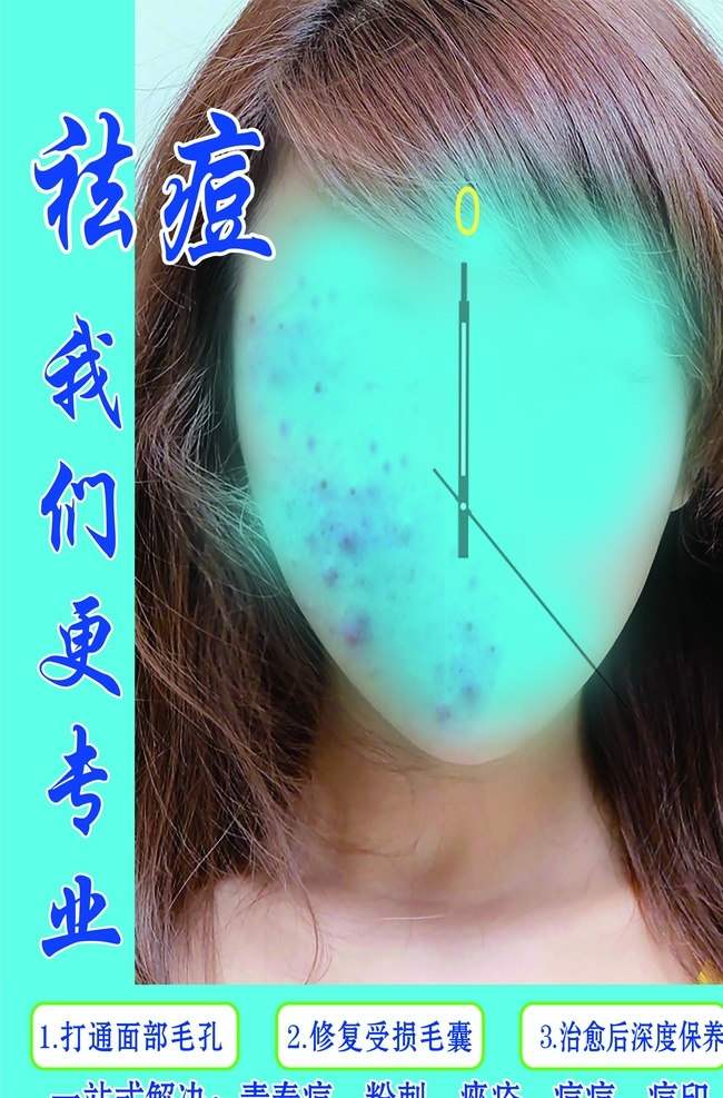 祛痘广告 祛痘海报 祛痘宣传单 祛痘美容 祛痘护肤 女士祛痘 专业祛痘 祛痘宣传 祛痘用品 专业祛痘海报 美容海报 美容院海报 美容祛痘海报 祛痘化妆品 祛痘促销 化妆品海报 美白祛痘海报 祛痘祛斑海报 祛痘整形 祛痘美女 祛斑 美容美体 青春痘 美肤 美容店 美容祛痘 皮肤管理