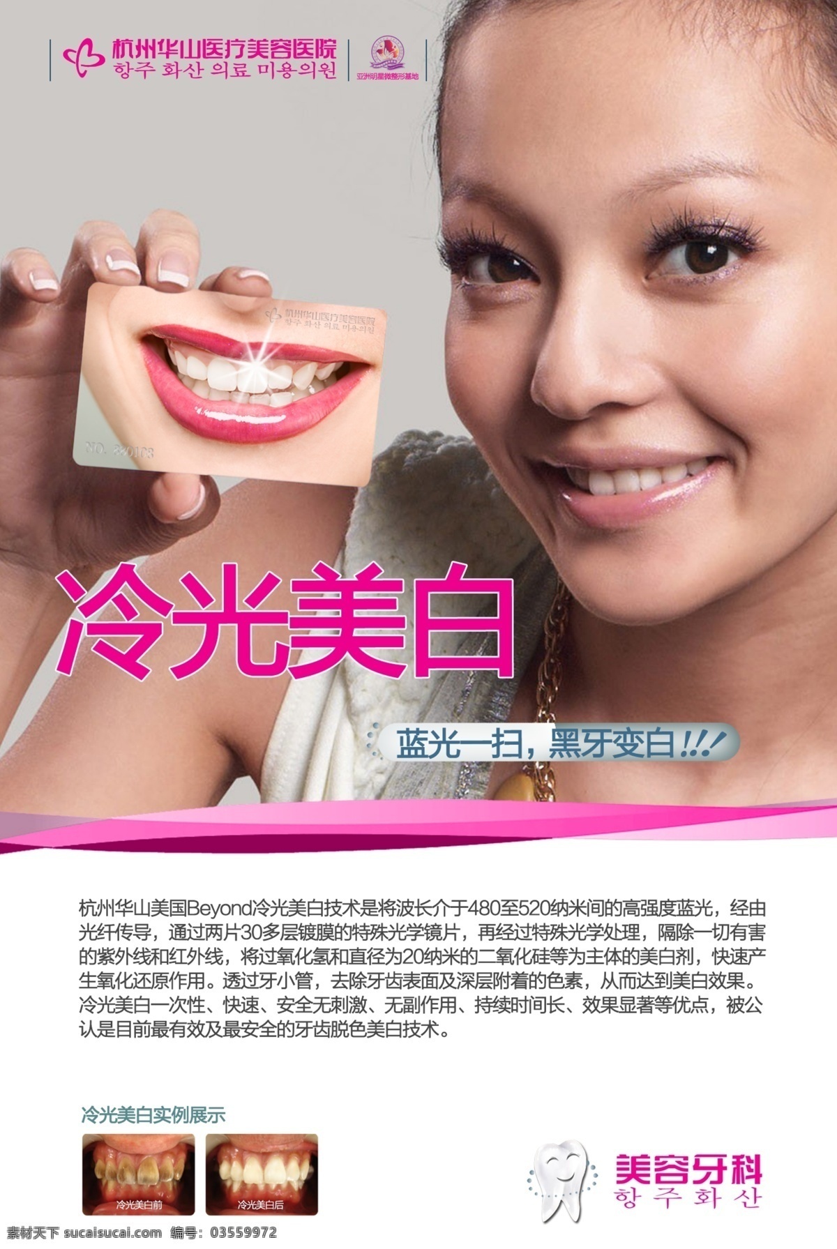 口腔美容 冷光 美白 杭州华山 医疗美容 医院 笑脸 微笑 女星 牙齿 刘海 亚洲 明星 微 整形 基地 皮肤美容仪器 分层 源文件