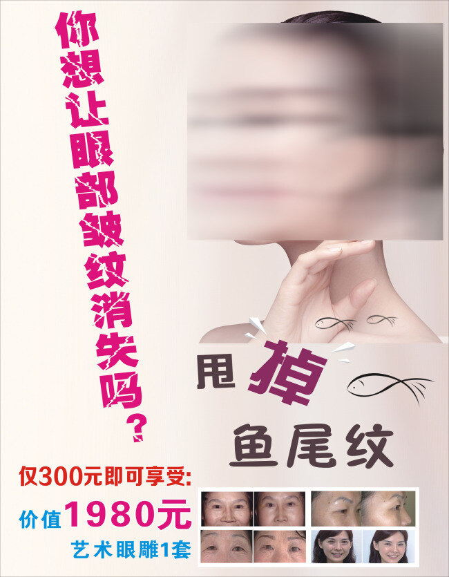 去掉鱼尾纹 美容 鱼尾纹 活动