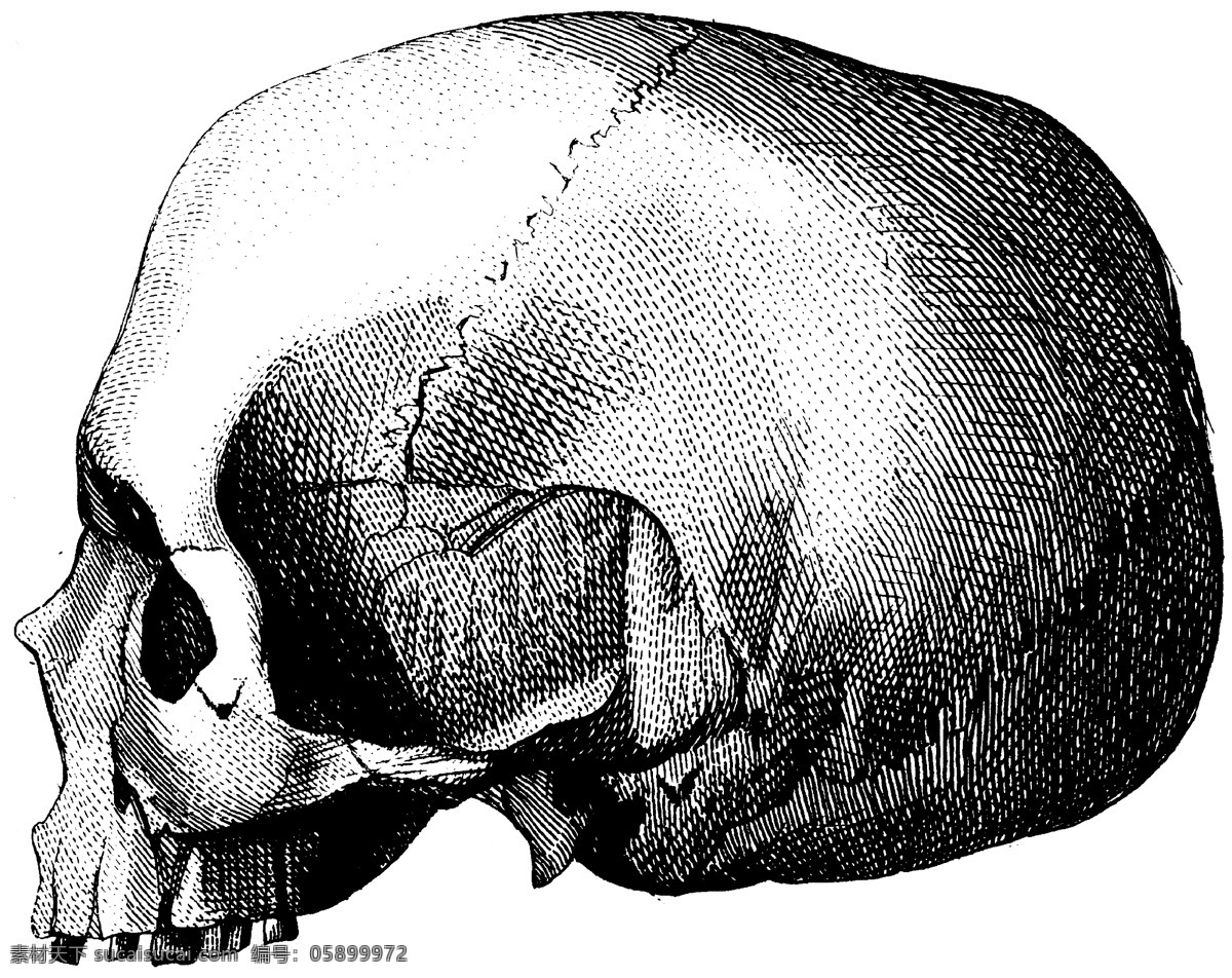 人体 头盖骨 侧面 上部 头骨 医学 解剖 法医 骷髅 人体解剖 医疗护理 现代科技