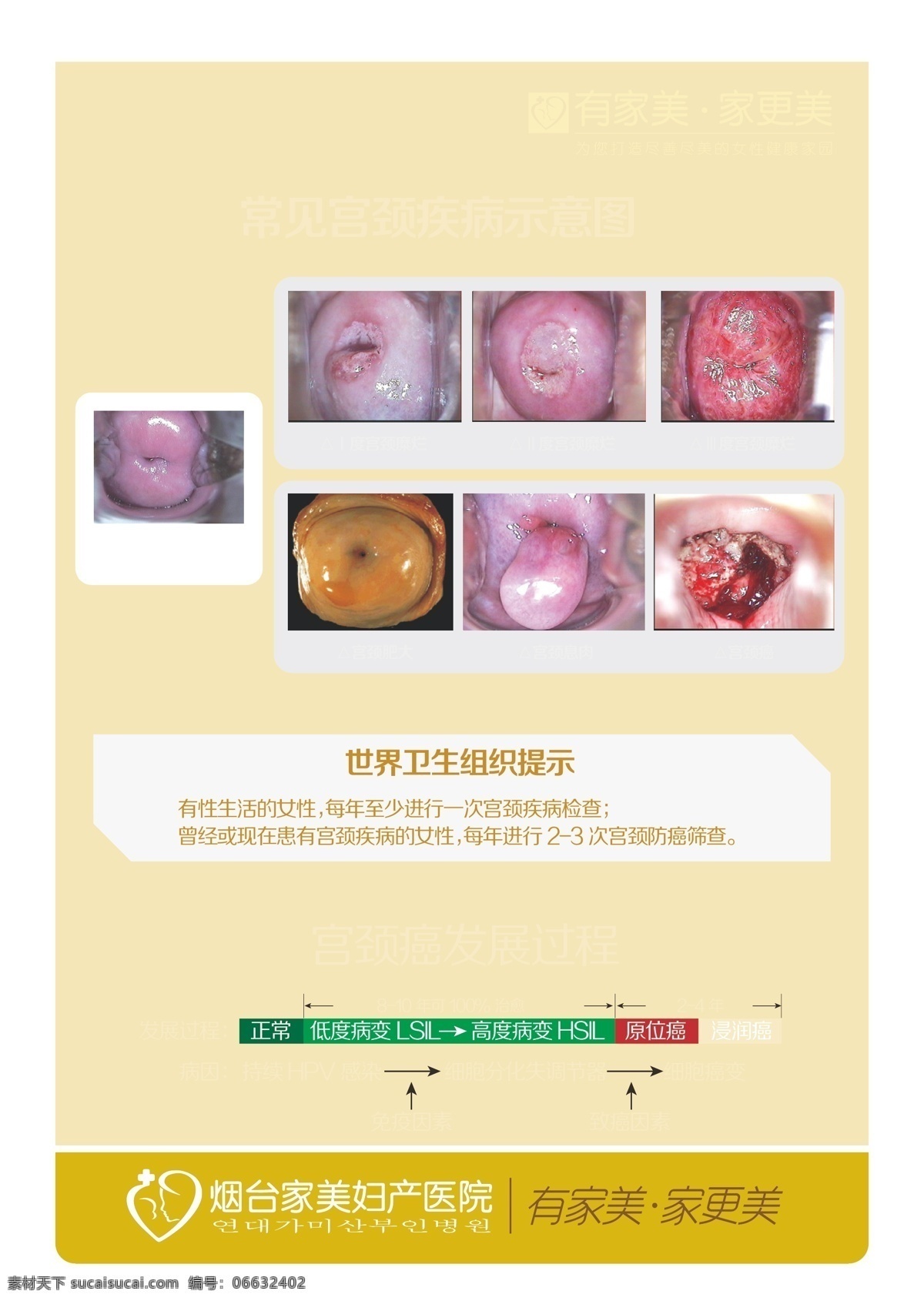 各种宫颈疾病 妇科 宫颈疾病 关爱 女性健康 宫颈糜烂 宫颈癌 宫颈 肥大