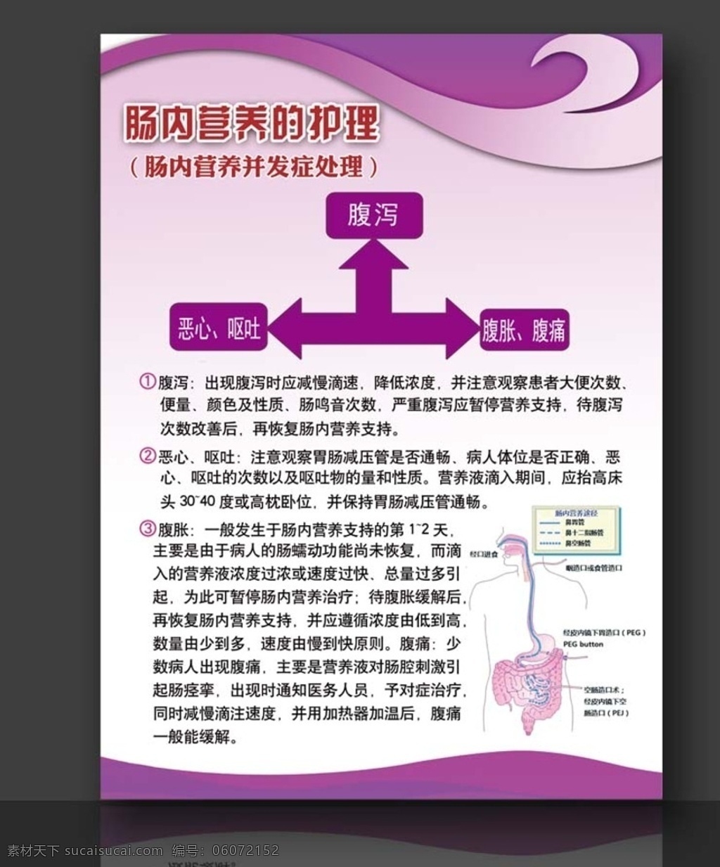 肠内营养 护理 腹部病症 肠内营养知识 营养护理 腹痛腹泻 并发症处理 灯箱片海报