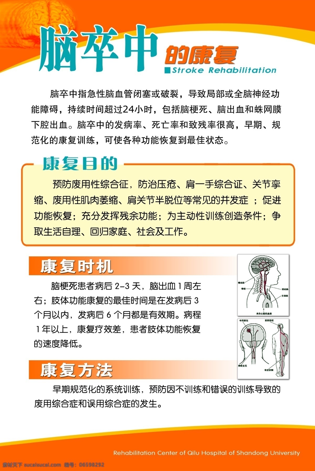 脑卒中的康复 医疗背景 大脑 人体 大脑构造 展板模板 广告设计模板 源文件