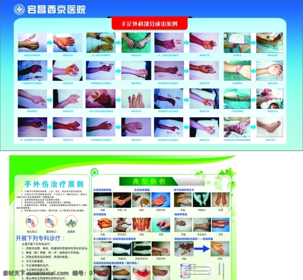 手足外科手术 手足外科 手术 断指 医院 展板