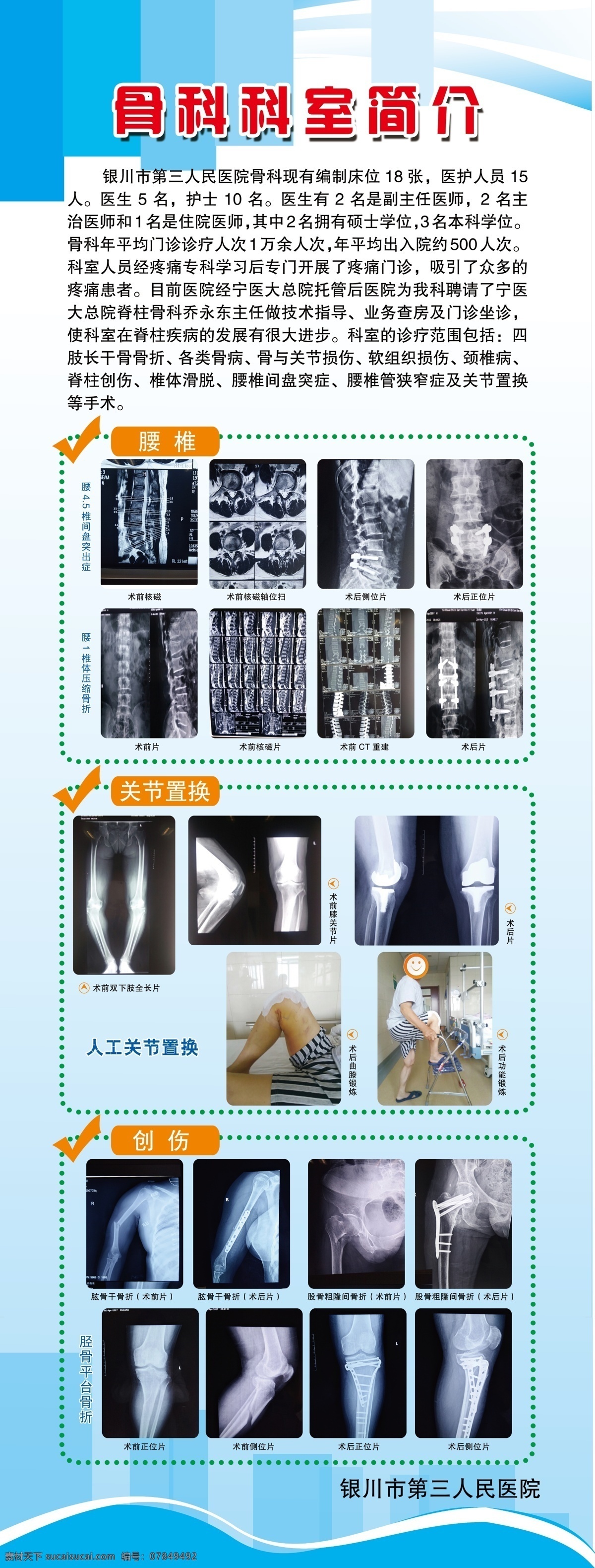 骨科易宝拉 医院展板 医疗展板 科室展板 专科展板 科室简介 专科特色 特色展板 仪器设备 特色项目 骨科 易拉宝 展架 分层