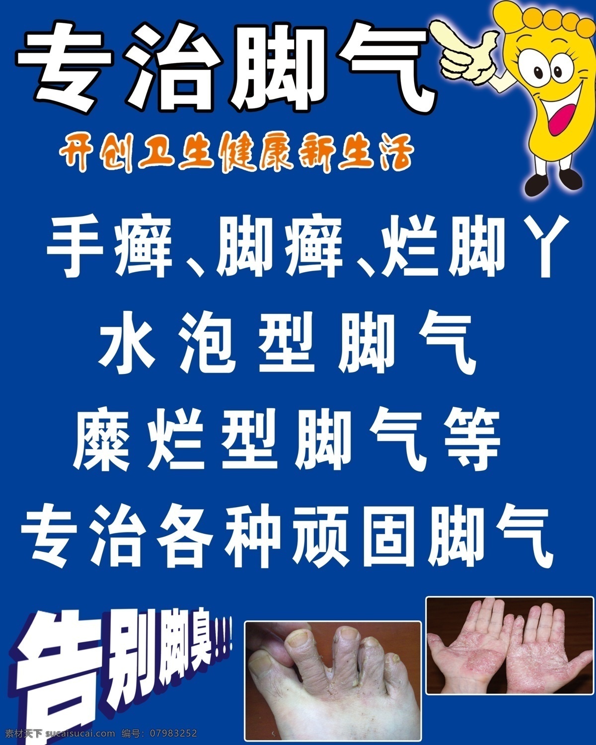 脚气海报 手癣 脚癣 烂脚丫 水泡 脚气 海报 分层