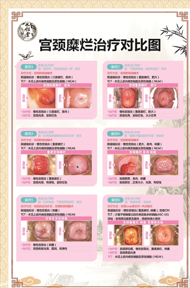 九归 堂 妇科病 展板 子宫肌瘤 宫颈糜烂 子宫 妇科疾病 名片卡片