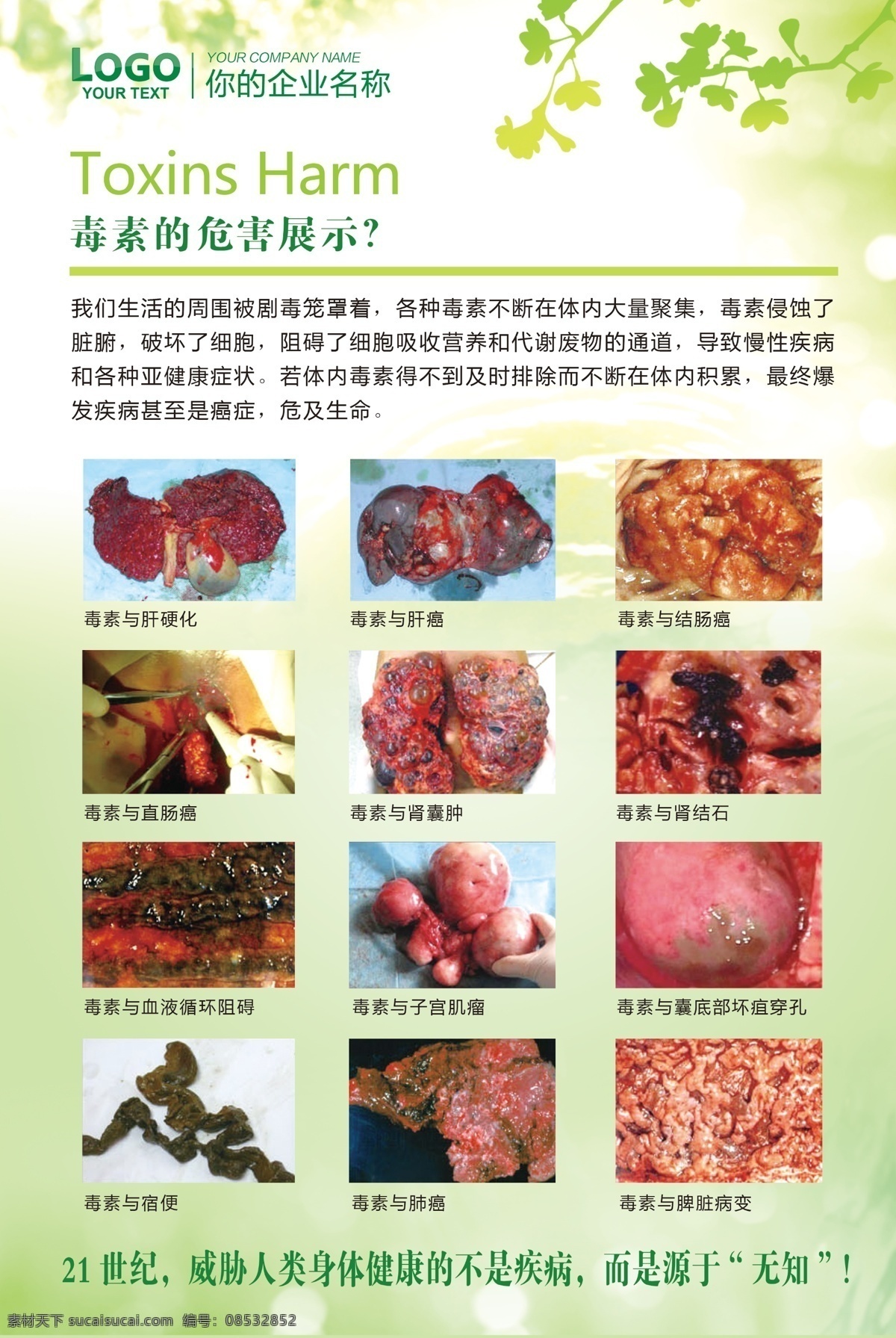 毒素的危害 排毒 肠 肠道 肠排 毒素 分层