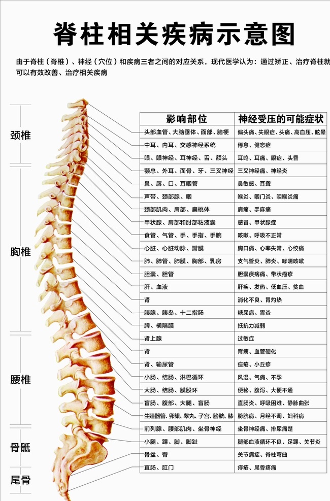 脊柱 相关 疾病 示意图 事宜图 脊柱疾病 疾病示意图