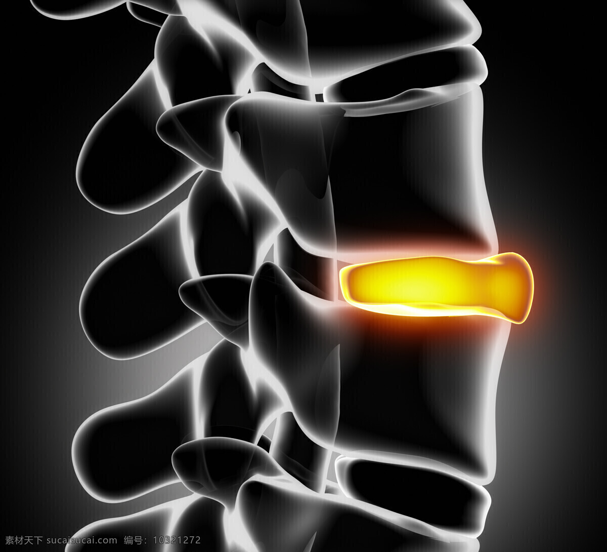 人体 骨骼 脊髓 脊椎 人体器官 医疗科学 医学 医疗护理 现代科技