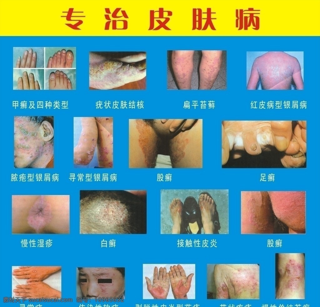 皮肤病 医疗保健 生活百科 矢量