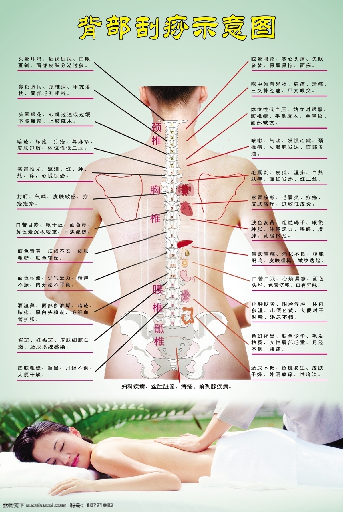 刮痧示意图 刮痧展板 背部刮痧挂画 按摩写真