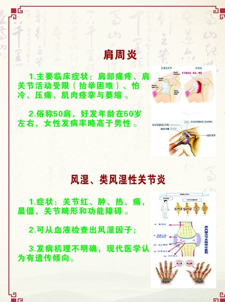 肩 周炎 肩周炎 炎 关节炎 cdr类