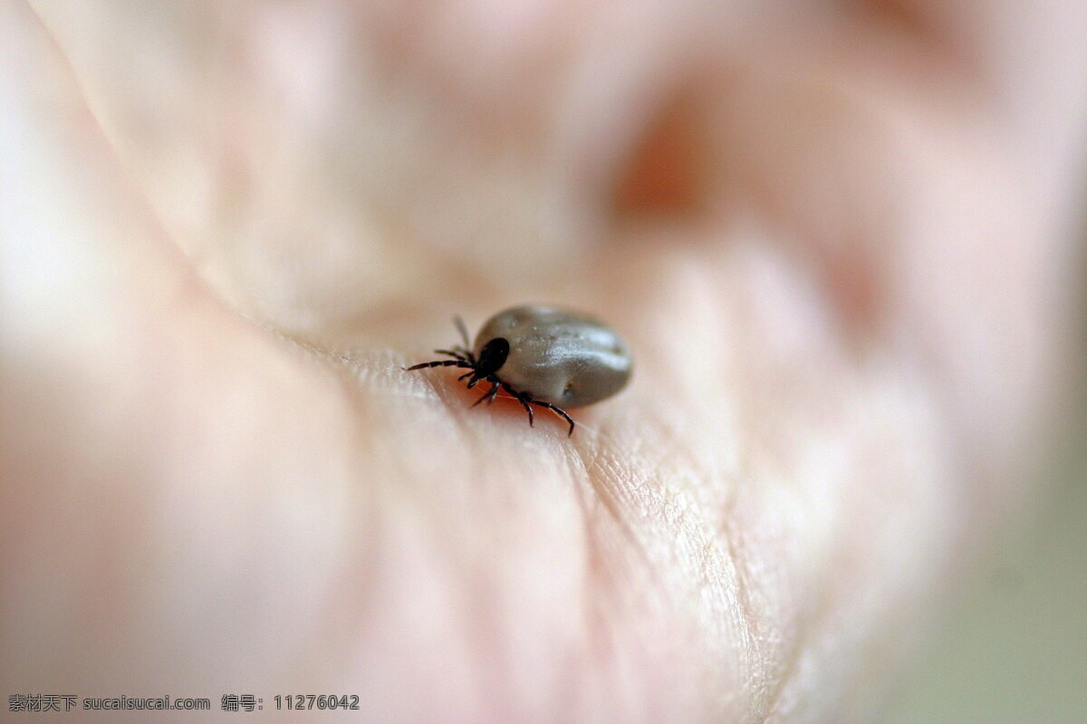 吸 血 蜱 虫 高清 蜱虫 壁虱 扁虱 寄生虫