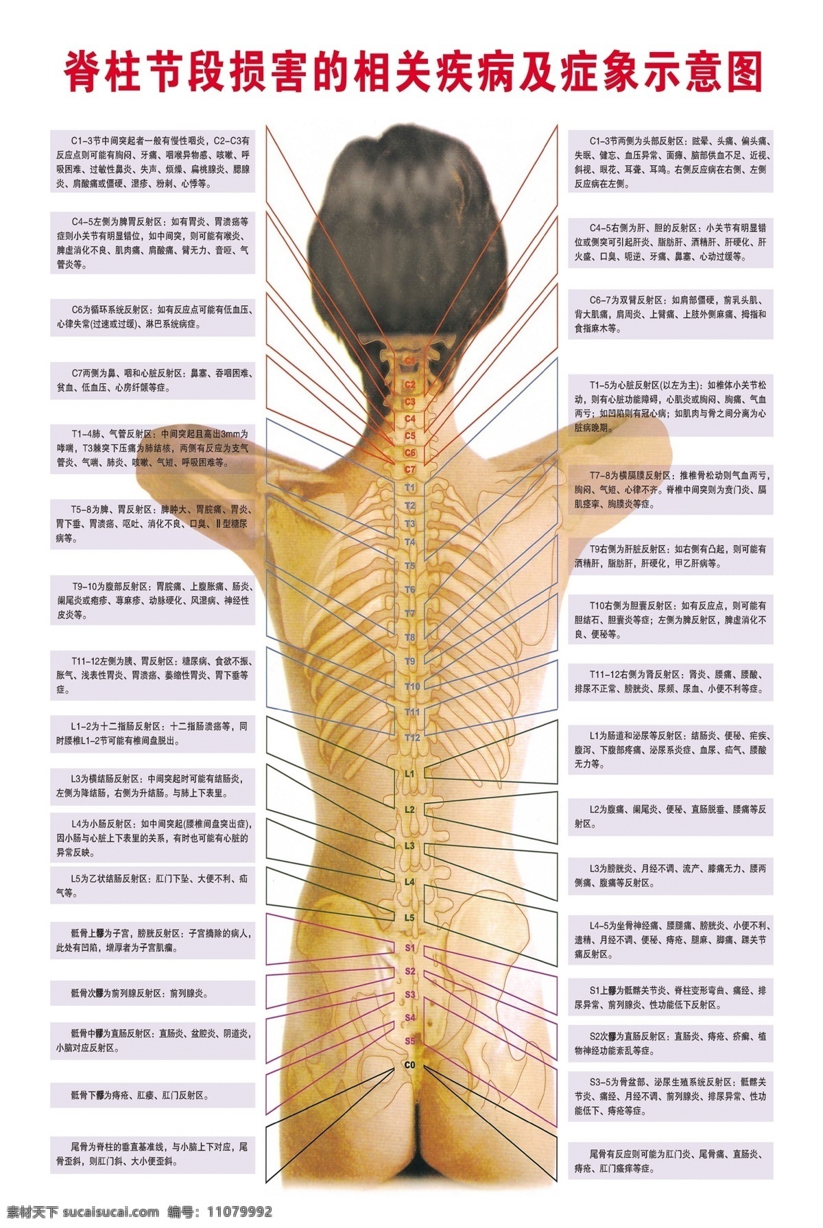 脊柱 脊柱示意图 脊椎图 脊柱图 脊柱展板 脊柱相关疾病 相关 疾病 示意图 展板模板 广告设计模板 源文件