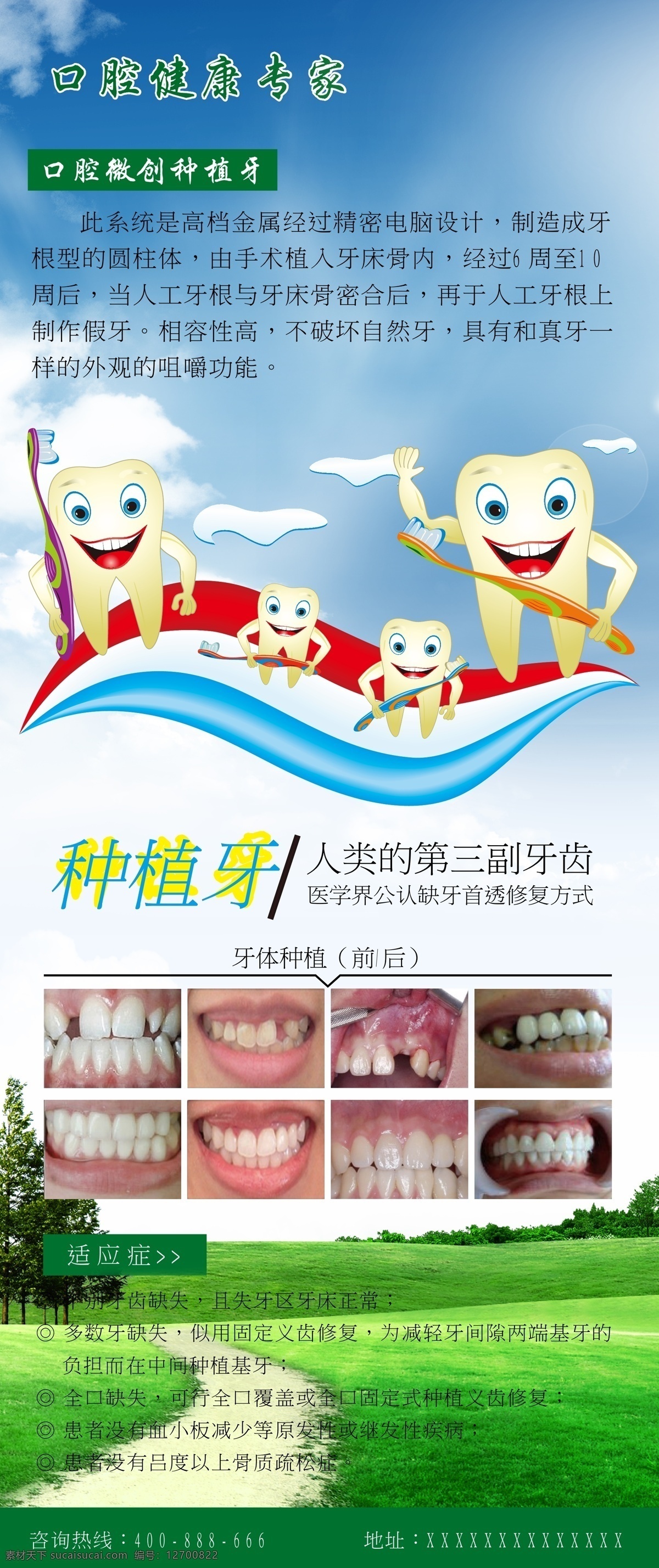 牙齿海报 牙 种植牙 海报 易拉宝 x展架 牙齿 牙齿失量图 口腔专家 矢量
