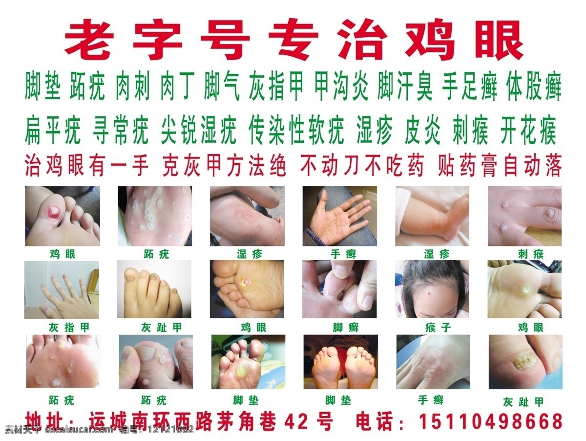 专治鸡眼 分层图 中药 运城 灰指甲 膏药 分层