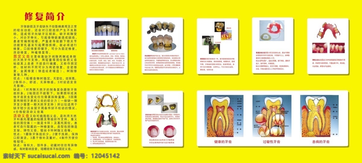 牙科简介 牙科 简介 烤瓷牙 隐形牙 钢托支架 牙齿 镀金牙 修复简介 挂图 广告设计模板 源文件