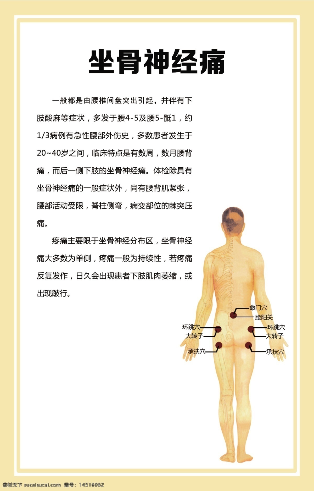 坐骨神经痛 病例 分析 诊断 原因 临床表现 病因 减轻 大腿 臀部 穴位